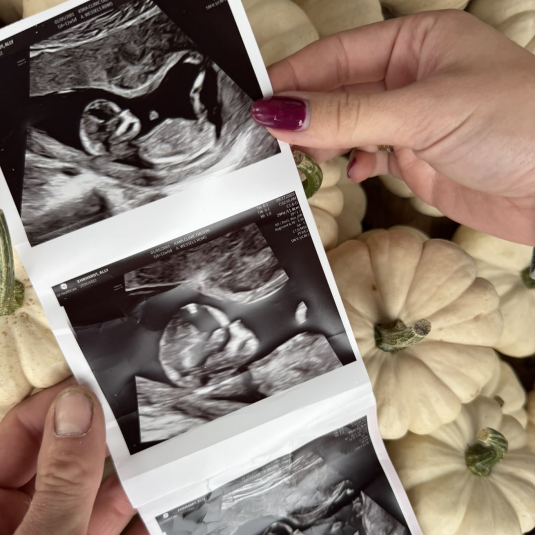 Photo shared by Ally for their Babylist baby registry.