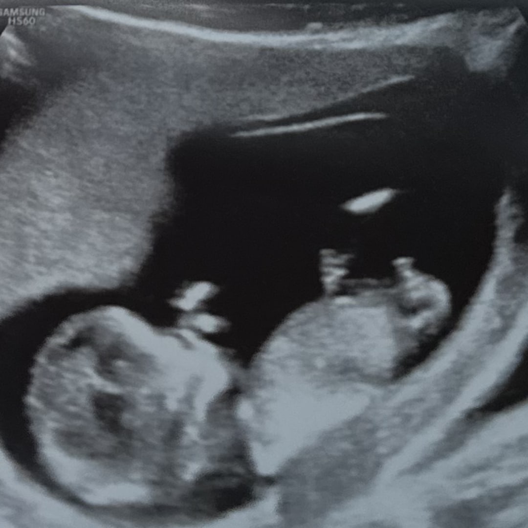 Photo shared by Iylana for their Babylist baby registry.