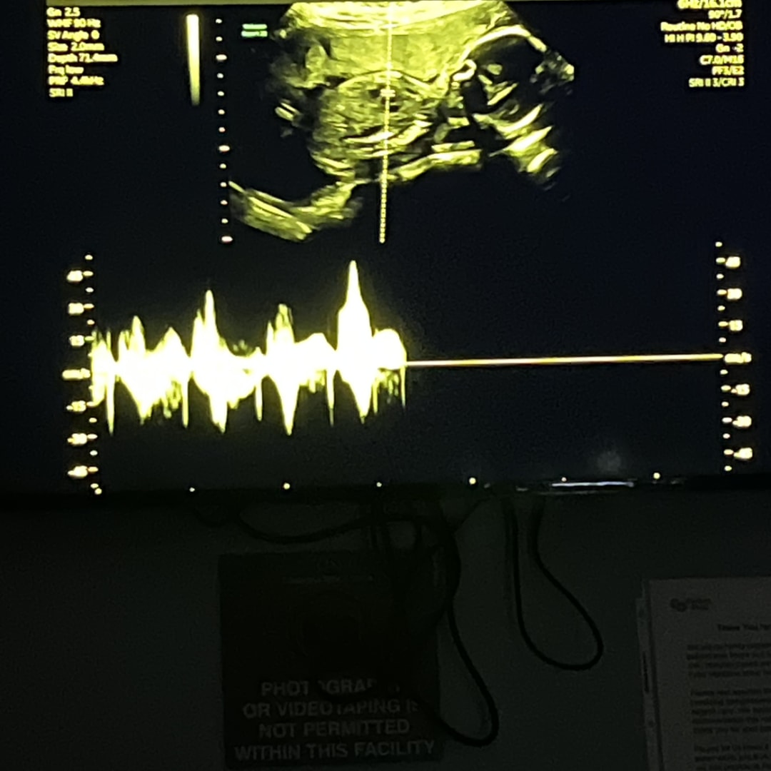 Photo shared by Camila for their Babylist baby registry.