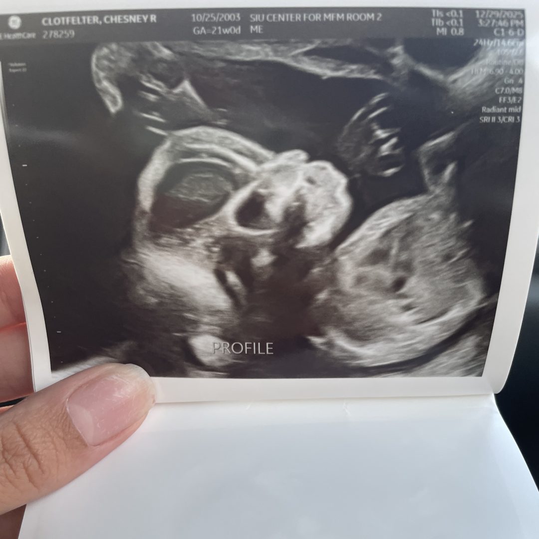 Photo shared by Chesney for their Babylist baby registry.