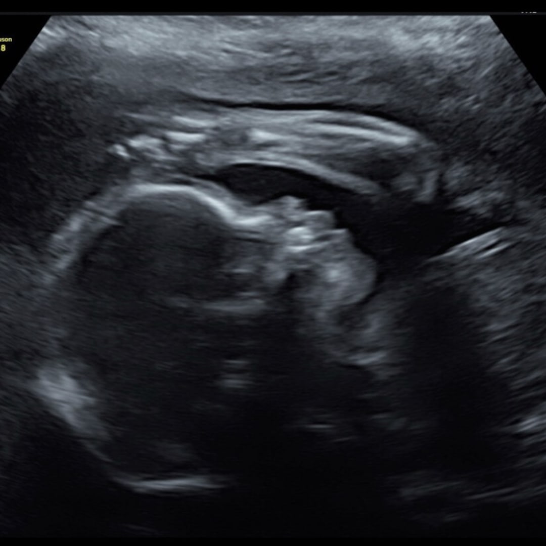 Photo shared by Ileana for their Babylist baby registry.