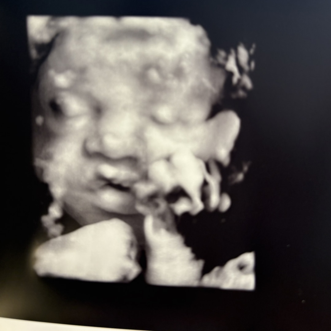 Photo shared by Keishawn for their Babylist baby registry.