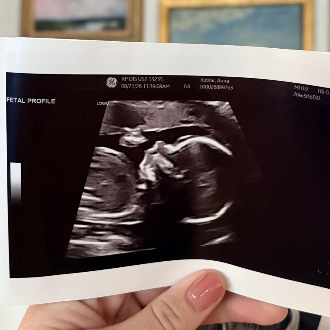 Photo shared by Anna for their Babylist baby registry.