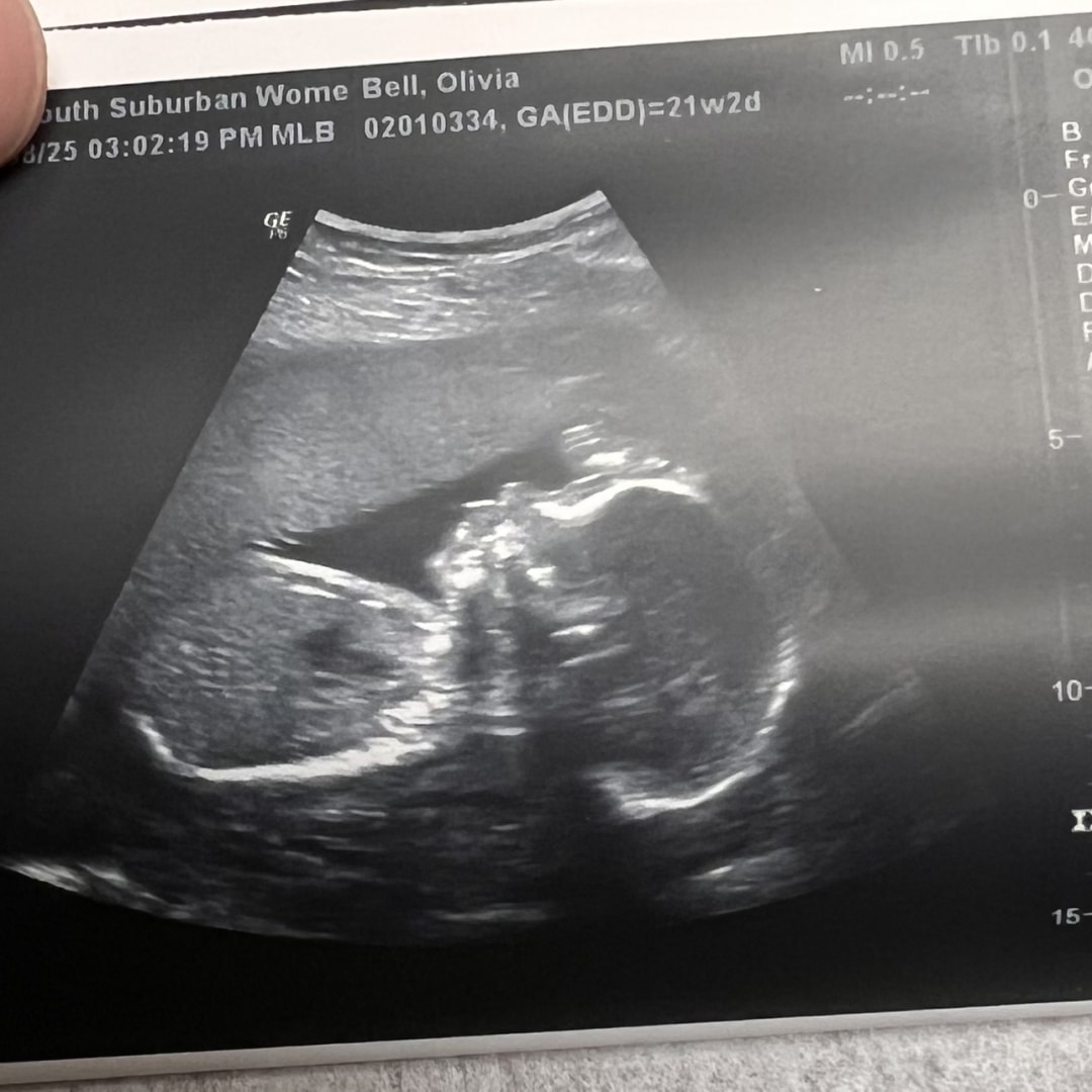 Photo shared by Olivia for their Babylist baby registry.