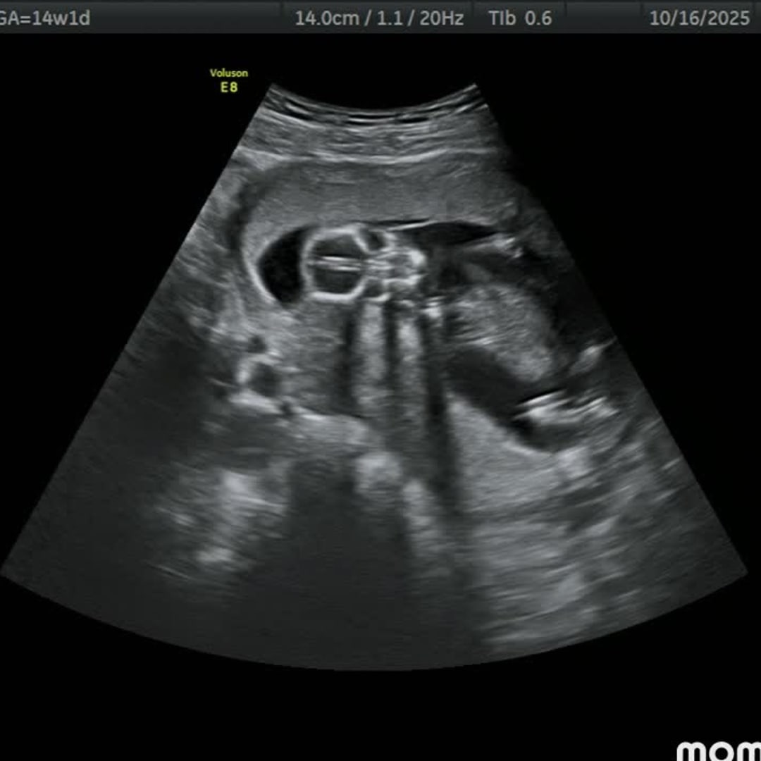 Photo shared by Ally for their Babylist baby registry.