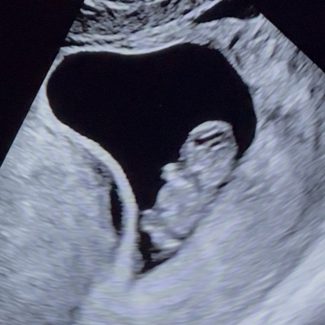 Photo shared by Mary for their Babylist baby registry.