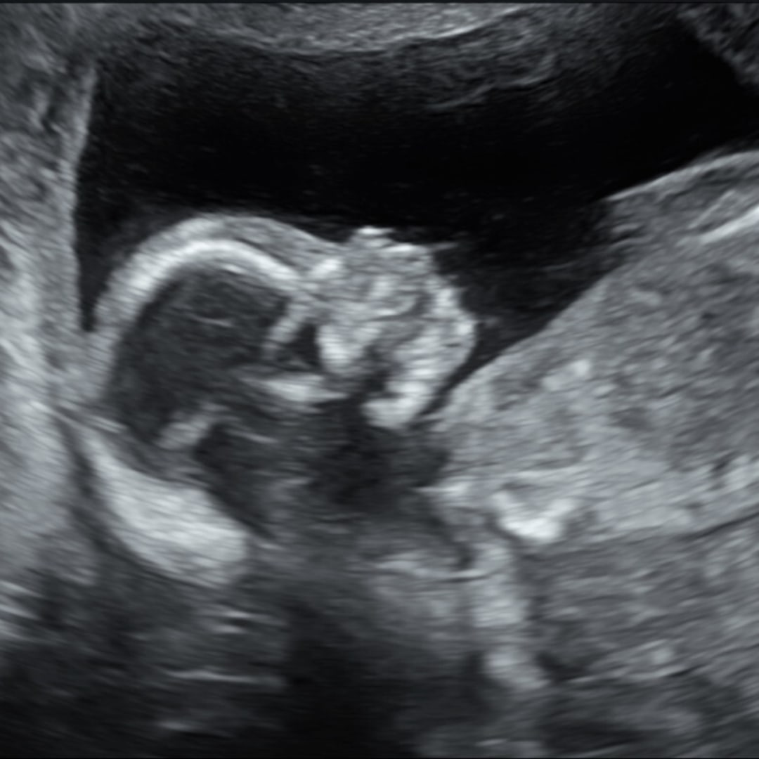 Photo shared by Jennifer for their Babylist baby registry.