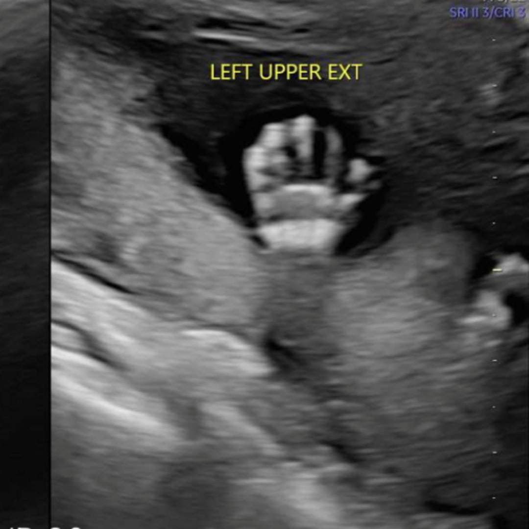 Photo shared by Jennifer for their Babylist baby registry.