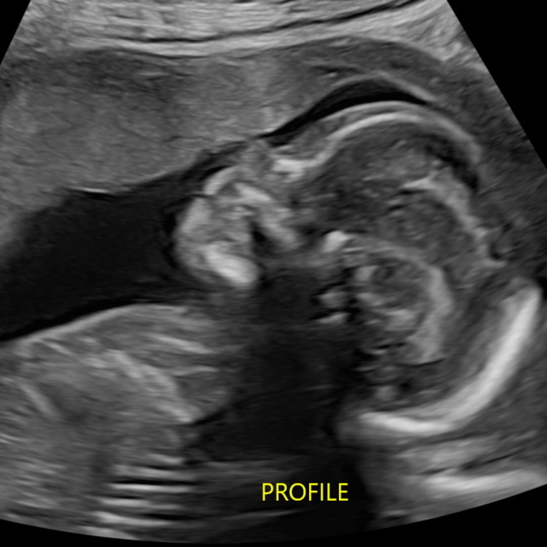 Photo shared by Grace for their Babylist baby registry.