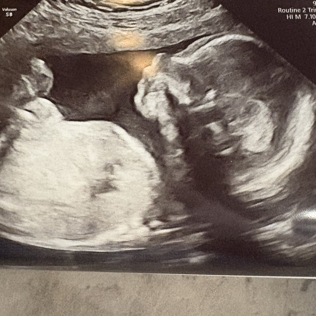 Photo shared by Kelly for their Babylist baby registry.