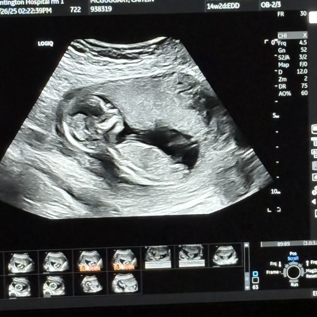 Photo shared by Caitlin for their Babylist baby registry.