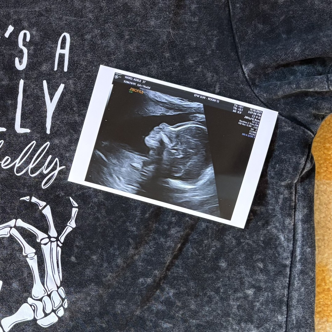 Photo shared by Adele for their Babylist baby registry.