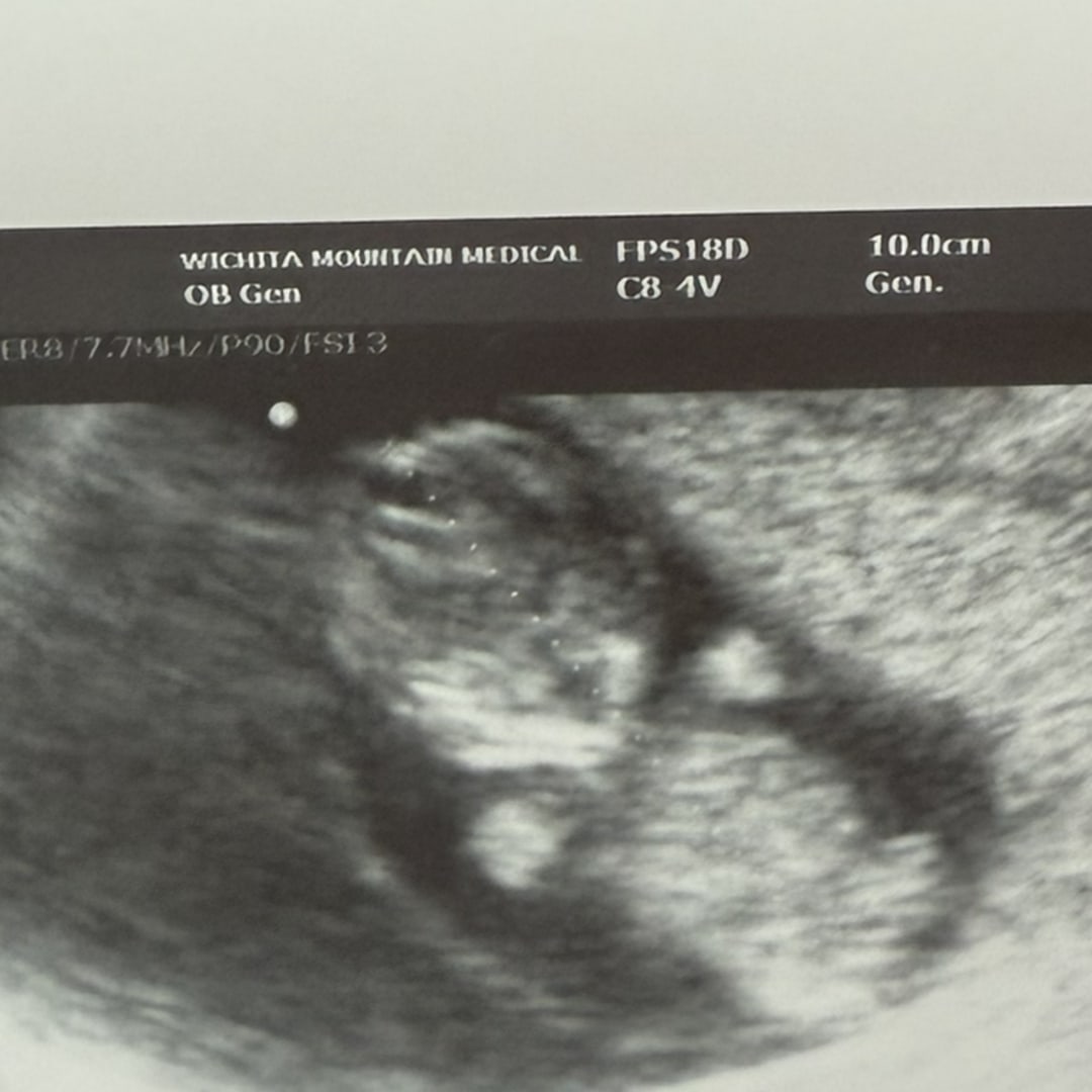 Photo shared by Jordan for their Babylist baby registry.