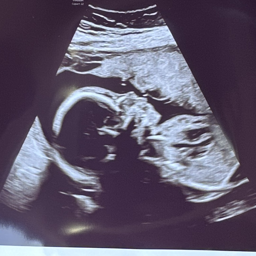 Photo shared by Megan for their Babylist baby registry.