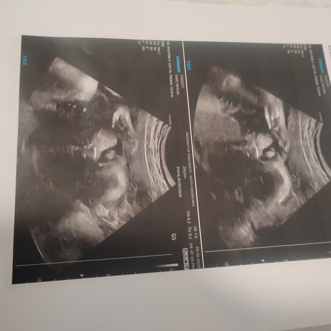 Photo shared by Melinda for their Babylist baby registry.