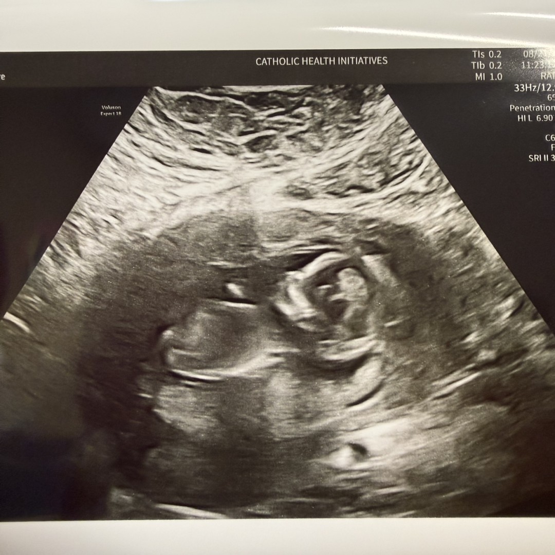 Photo shared by Sheita for their Babylist baby registry.