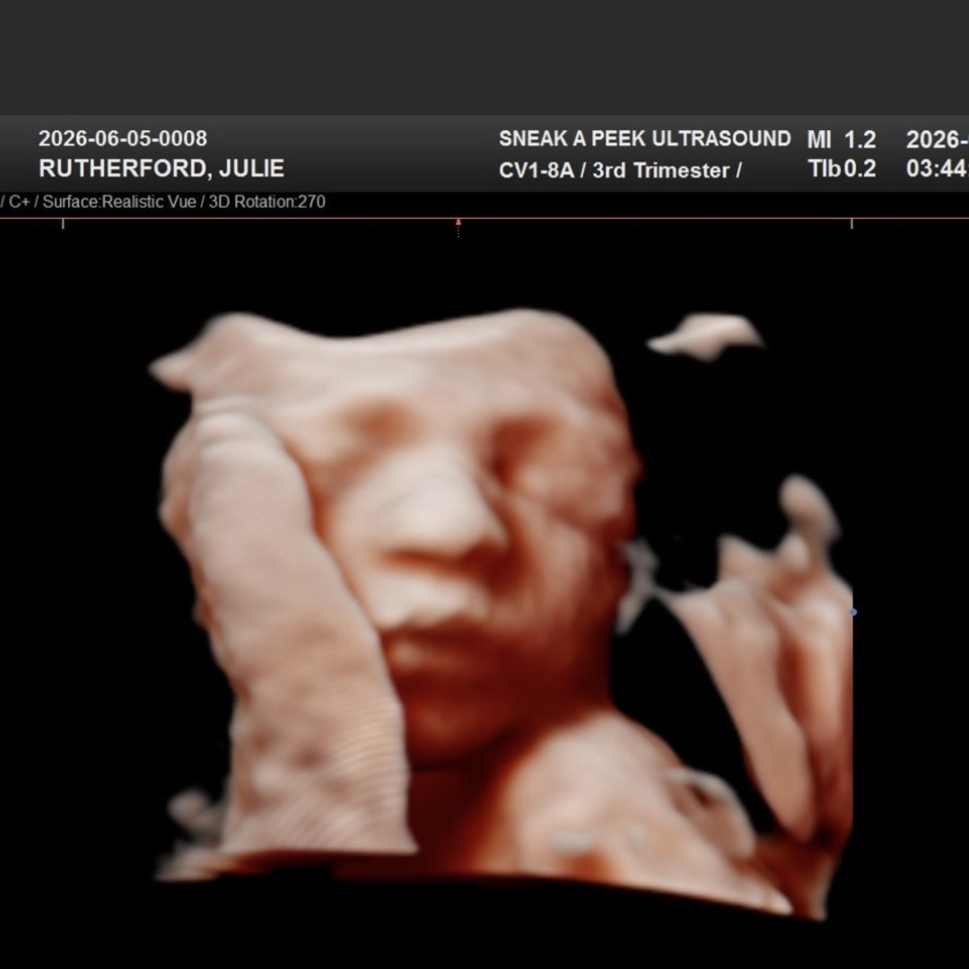 Photo shared by Julie for their Babylist baby registry.