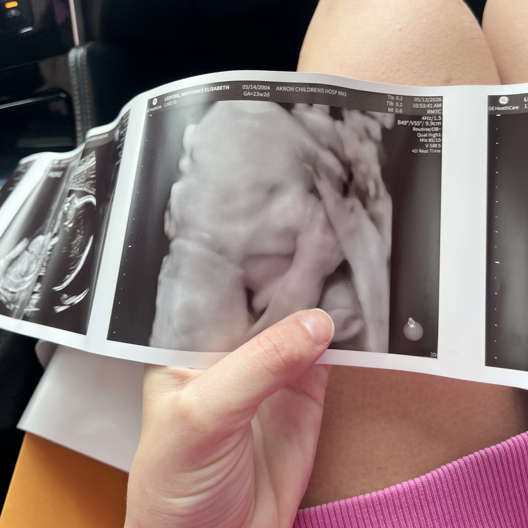 Photo shared by Gracie for their Babylist baby registry.