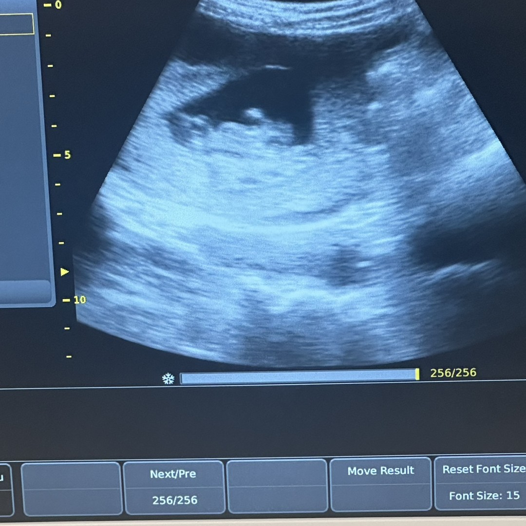 Photo shared by Becca for their Babylist baby registry.