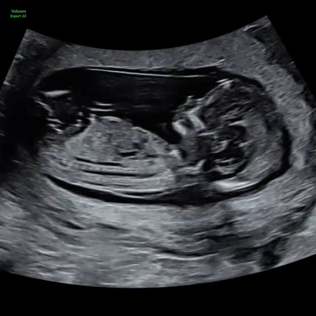 Photo shared by Desiree for their Babylist baby registry.