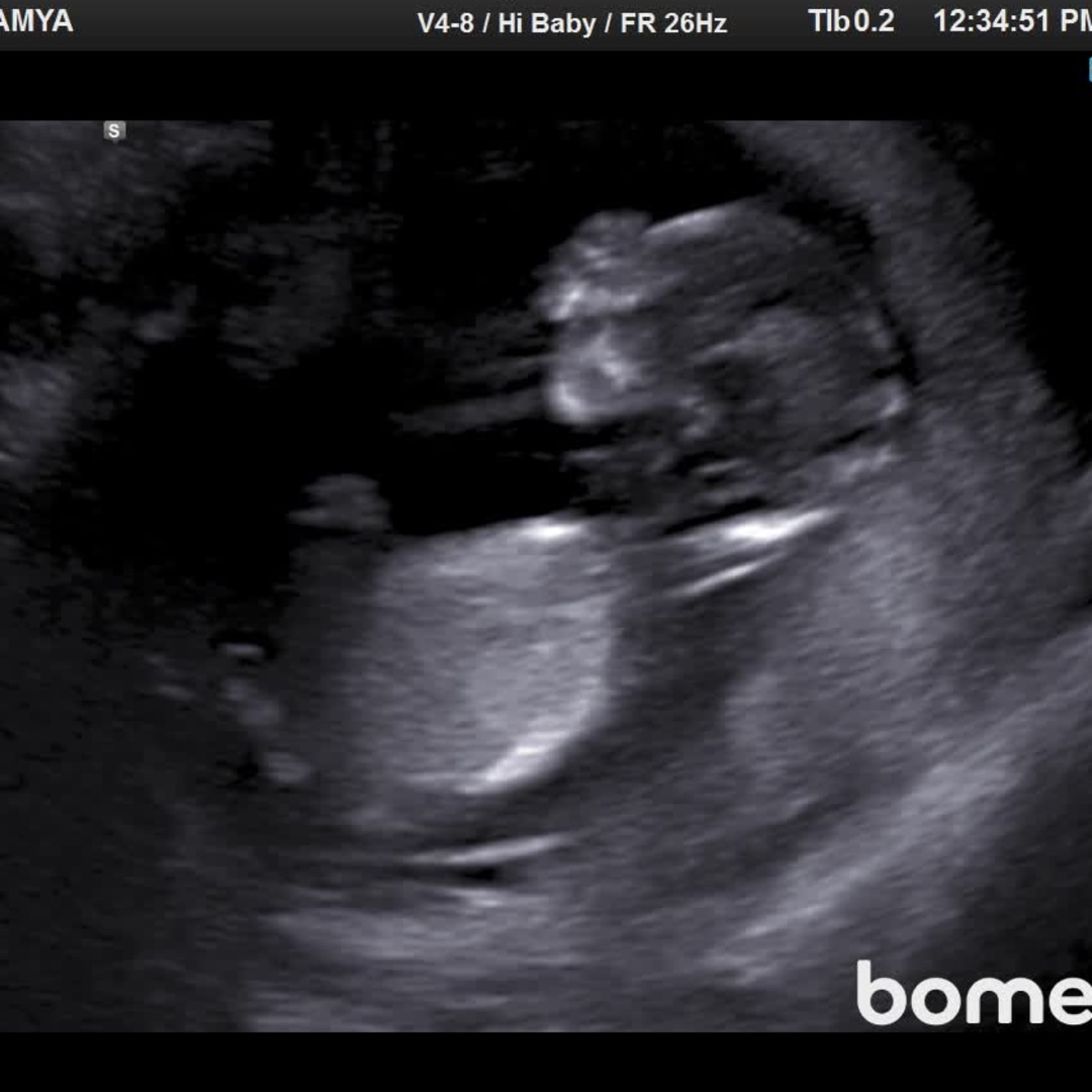 Photo shared by SaMya for their Babylist baby registry.