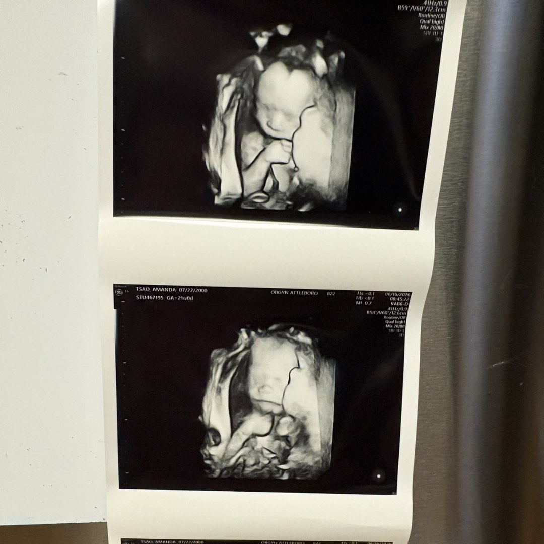 Photo shared by Amanda for their Babylist baby registry.