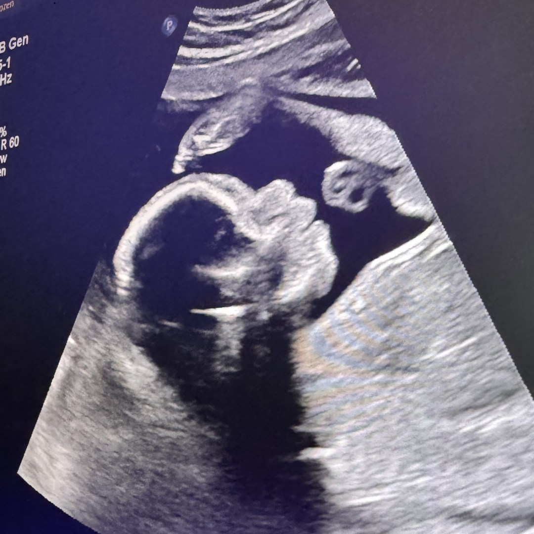 Photo shared by Stacey for their Babylist baby registry.