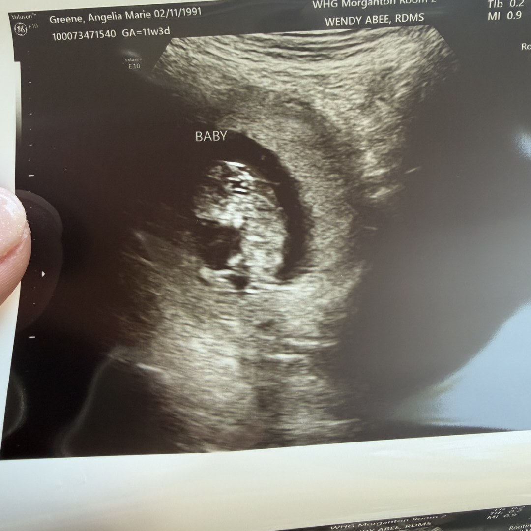 Photo shared by Angelia for their Babylist baby registry.