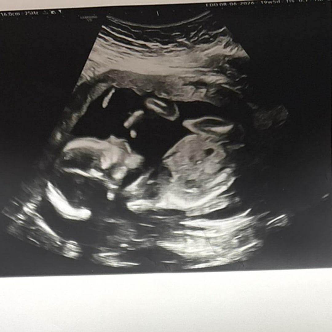 Photo shared by Alsatia for their Babylist baby registry.