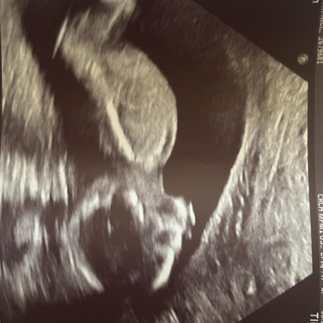 Photo shared by Chyann for their Babylist baby registry.