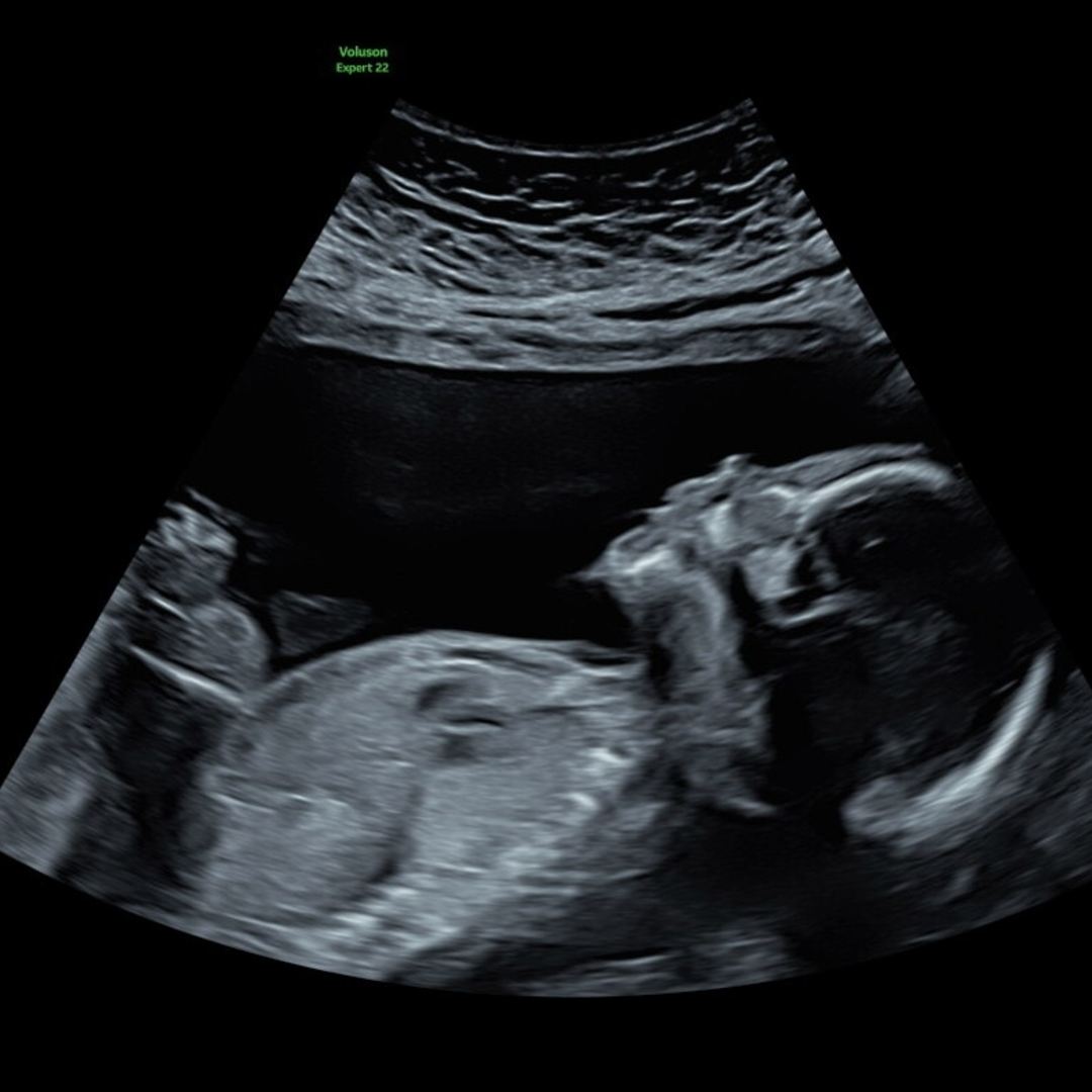 Photo shared by Jemima for their Babylist baby registry.