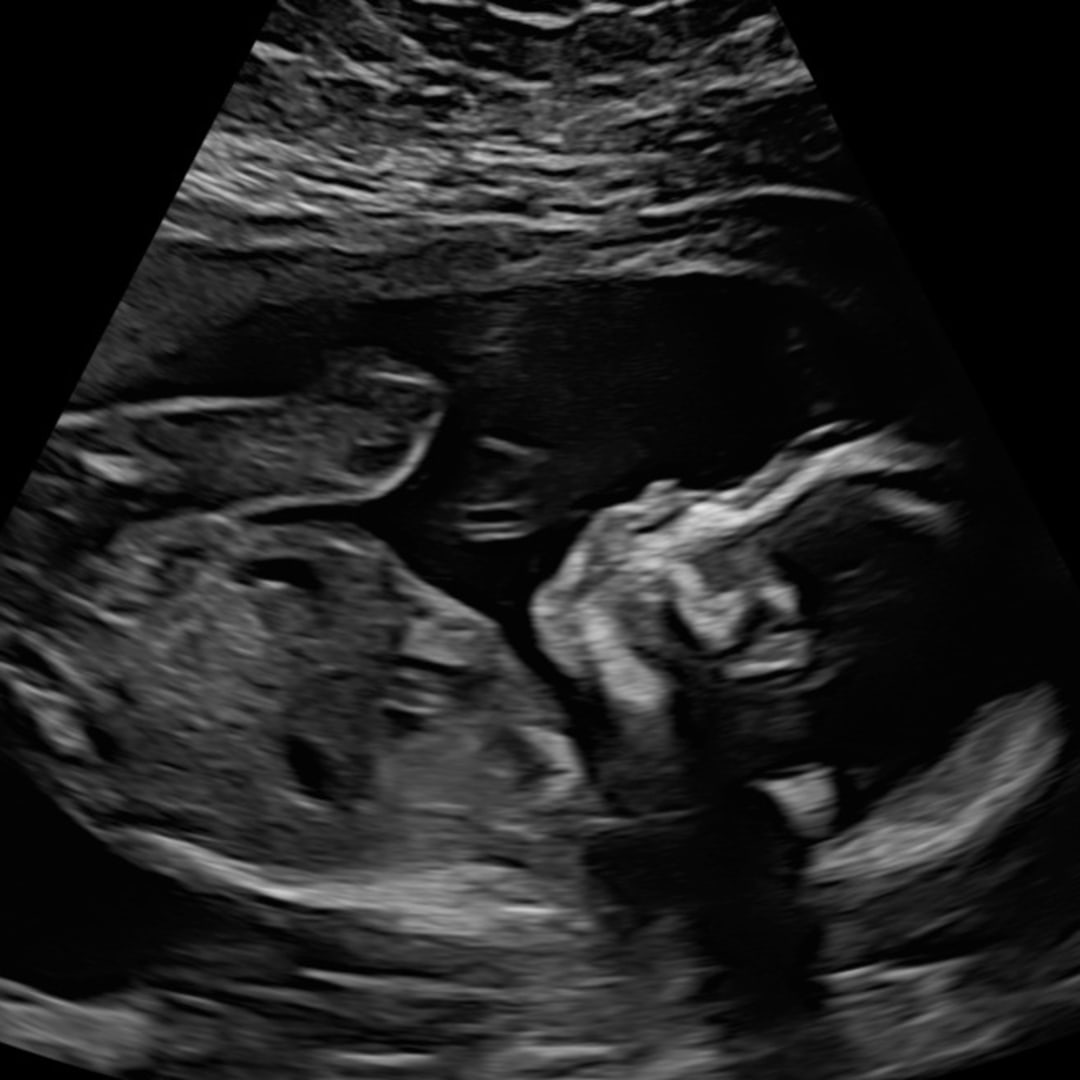 Photo shared by Lexie for their Babylist baby registry.