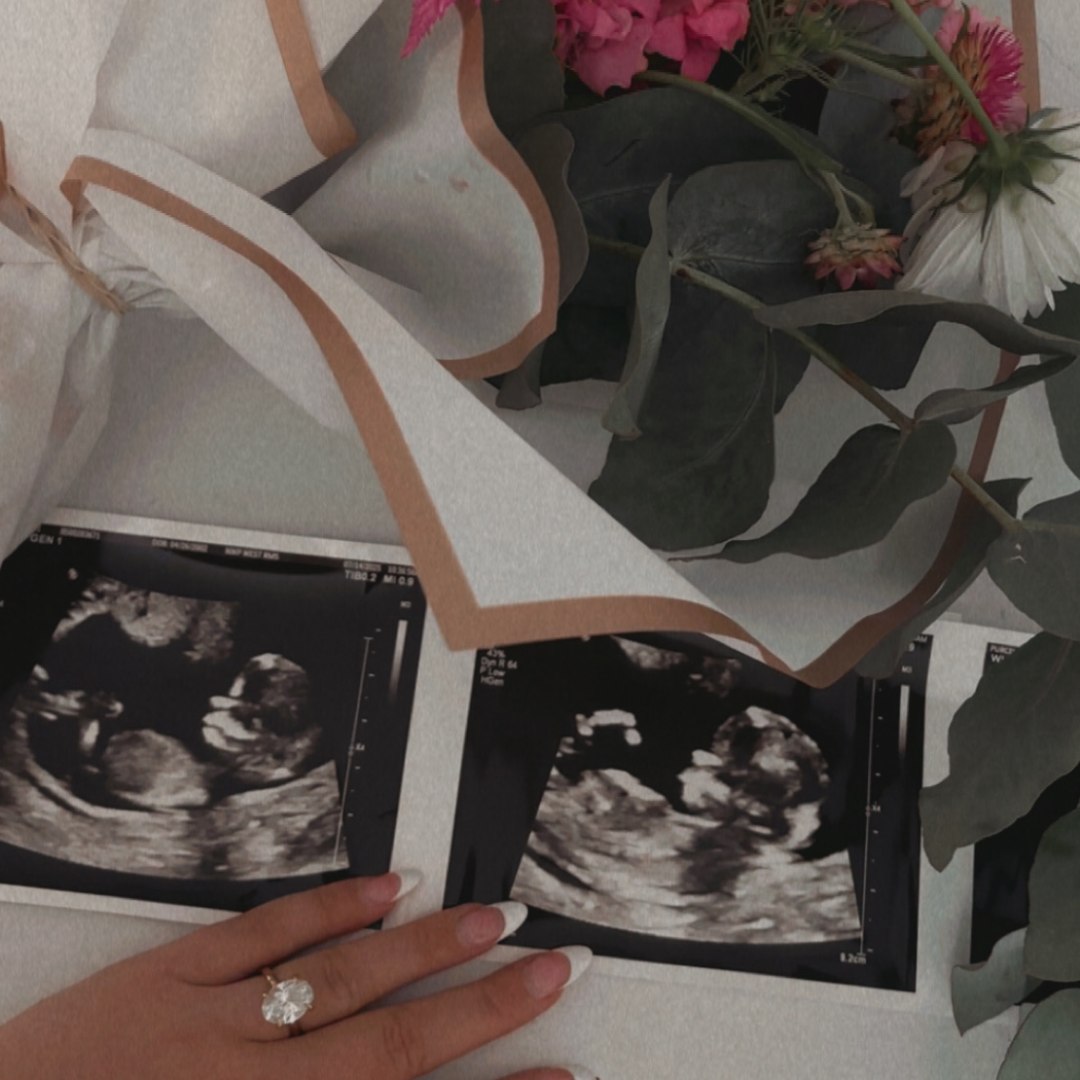 Photo shared by Hope for their Babylist baby registry.