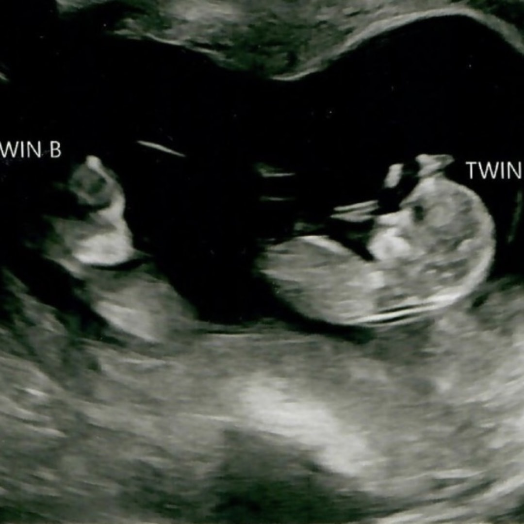Photo shared by Brent for their Babylist baby registry.