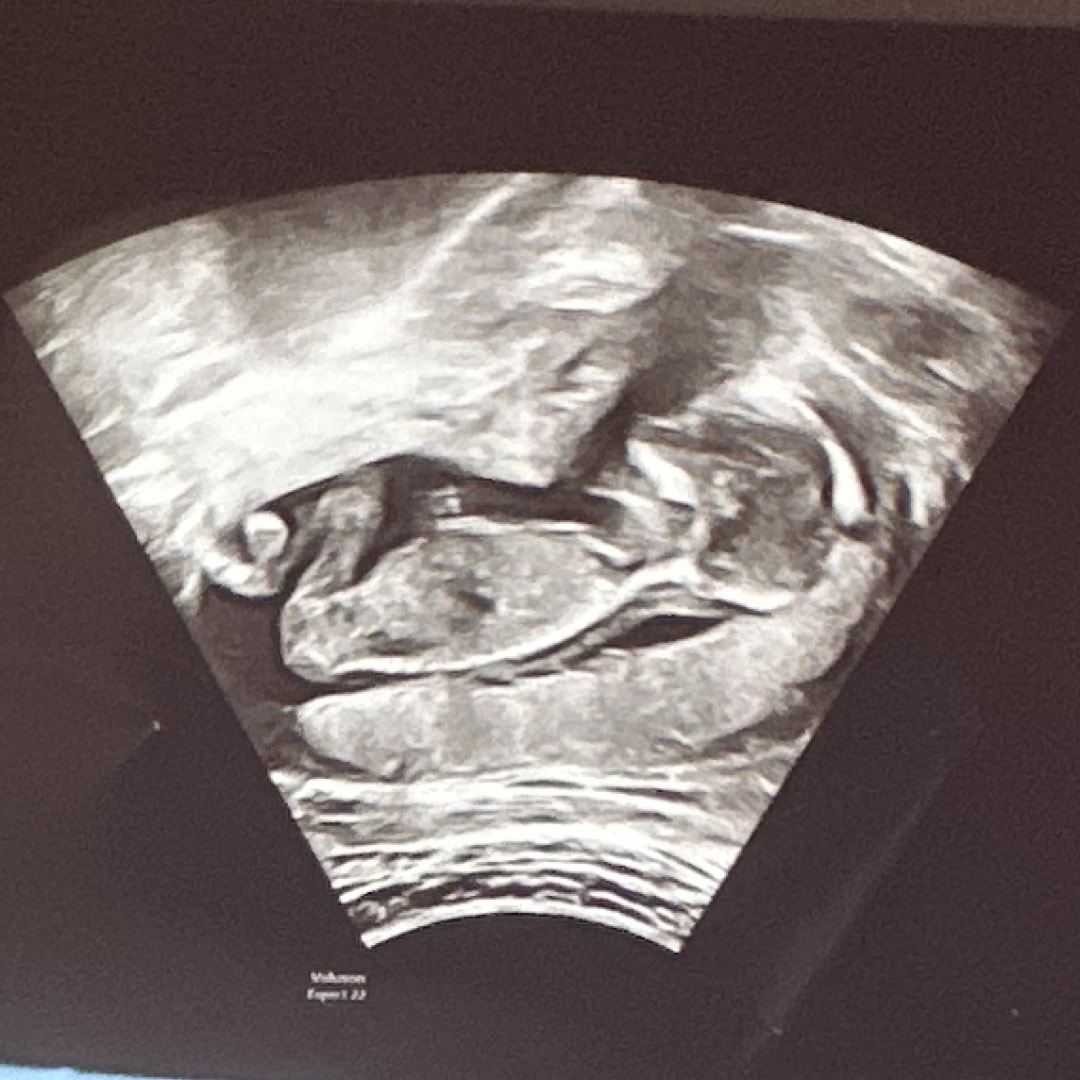 Photo shared by Destenie for their Babylist baby registry.