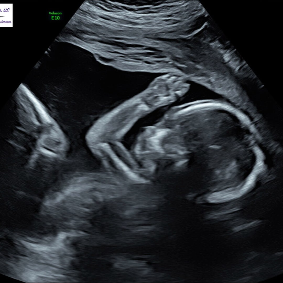 Photo shared by Kalena for their Babylist baby registry.