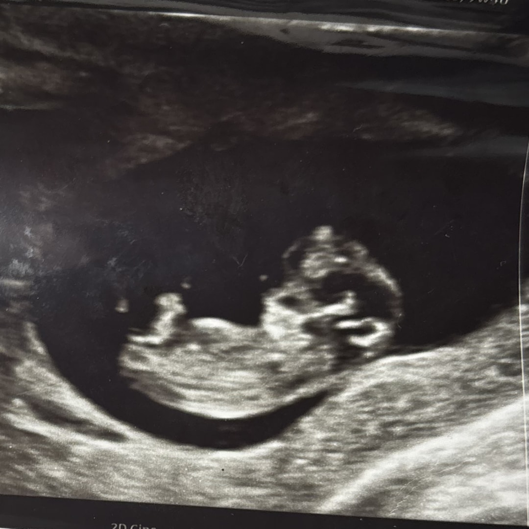 Photo shared by Makayla for their Babylist baby registry.