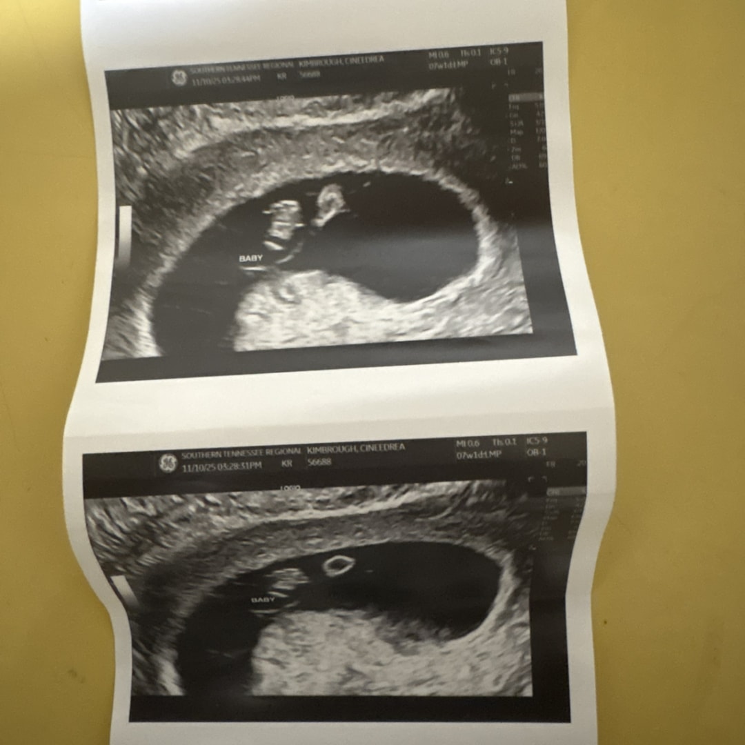 Photo shared by Cineedrea for their Babylist baby registry.