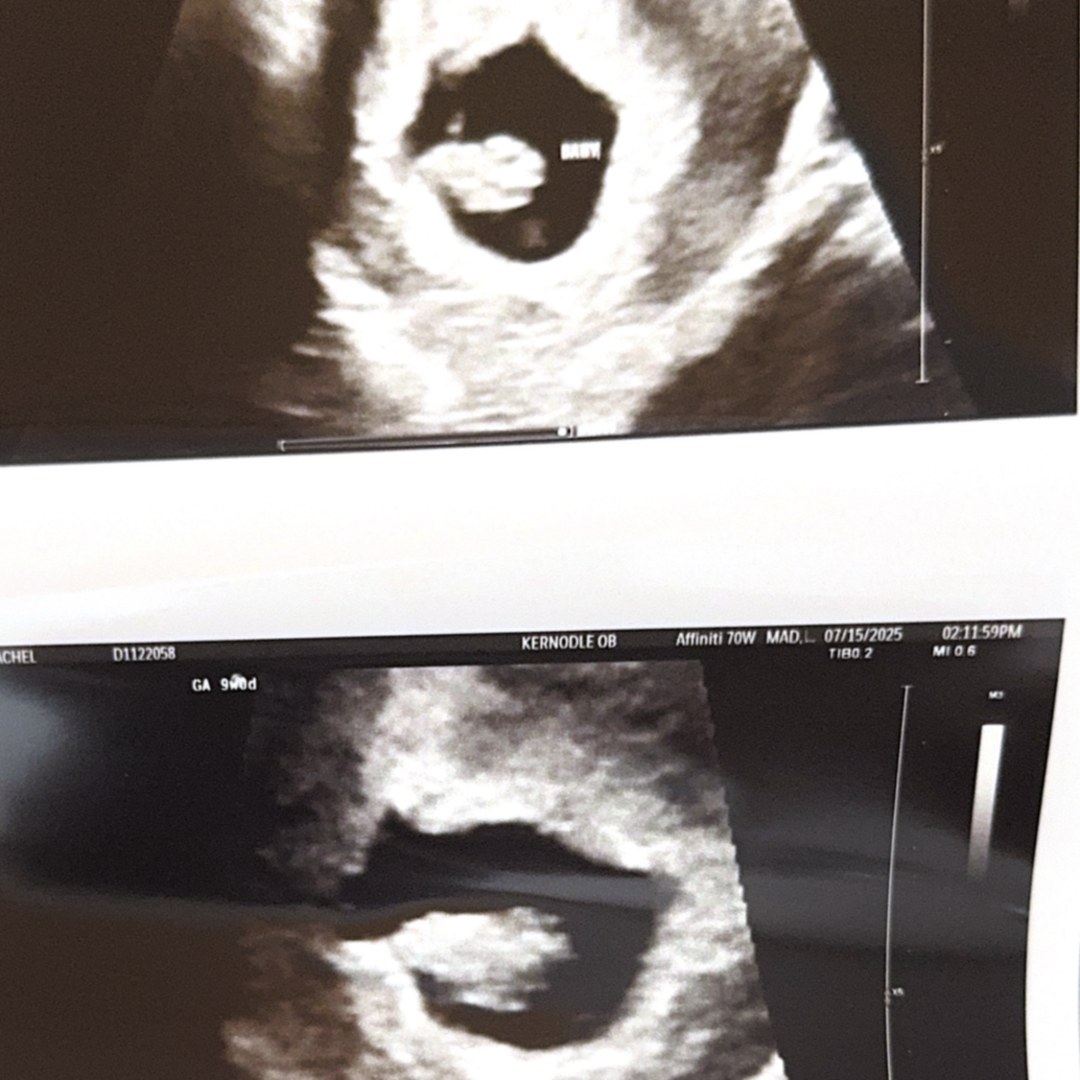 Photo shared by Bryce for their Babylist baby registry.