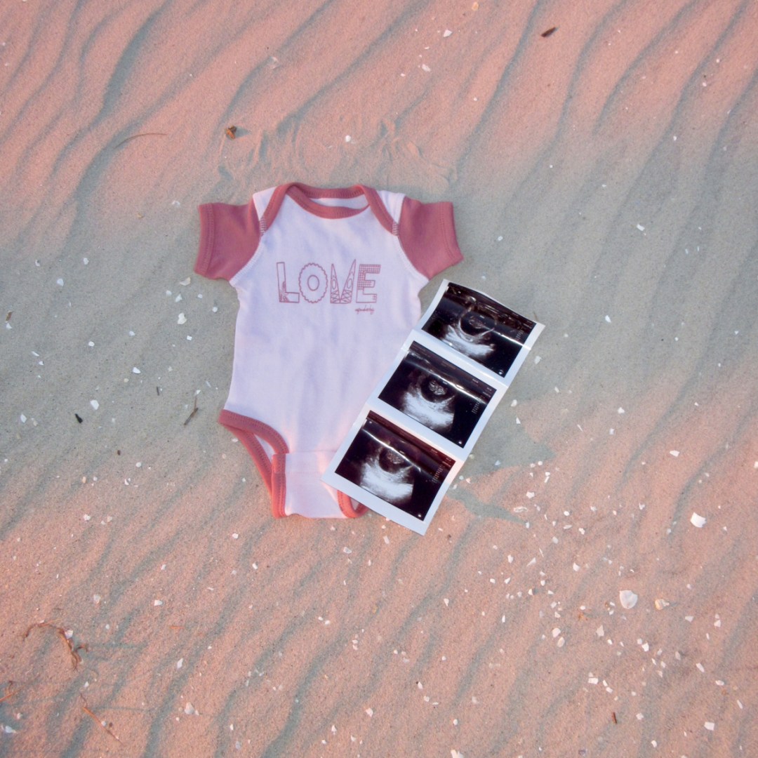 Photo shared by Madison for their Babylist baby registry.