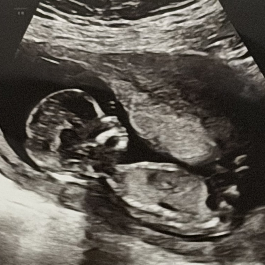 Photo shared by Riley for their Babylist baby registry.