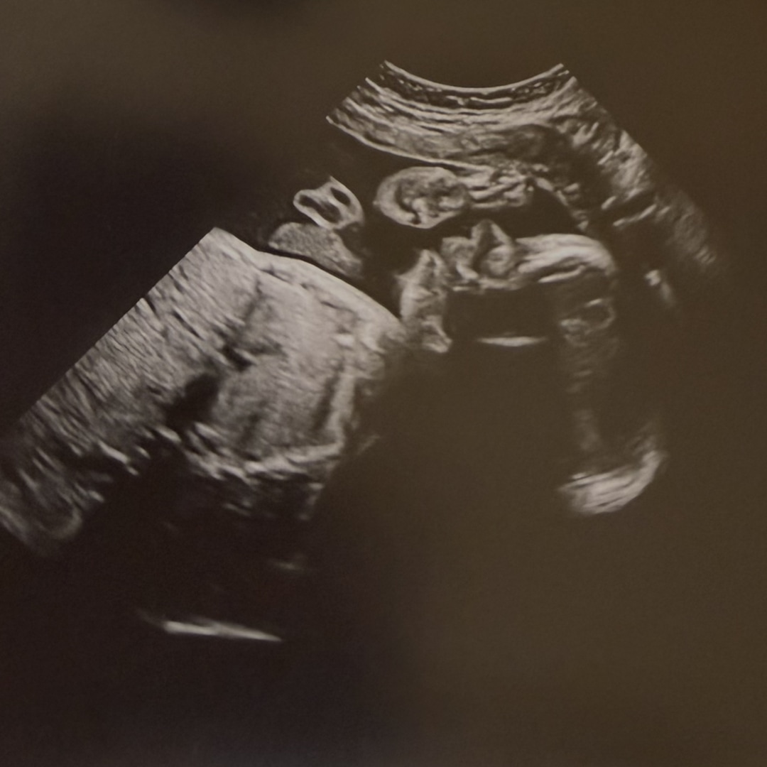 Photo shared by Paige for their Babylist baby registry.