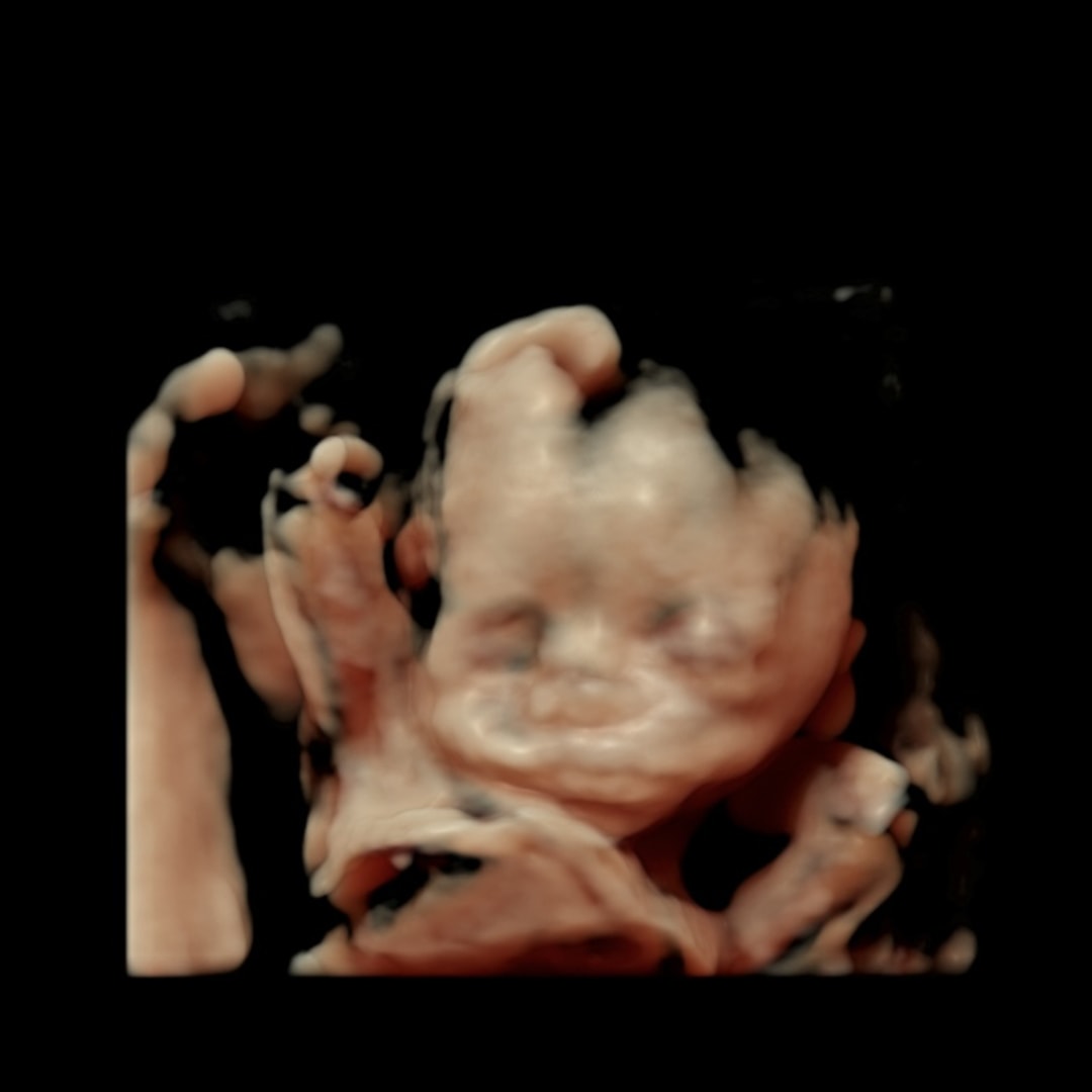 Photo shared by Stephanie for their Babylist baby registry.