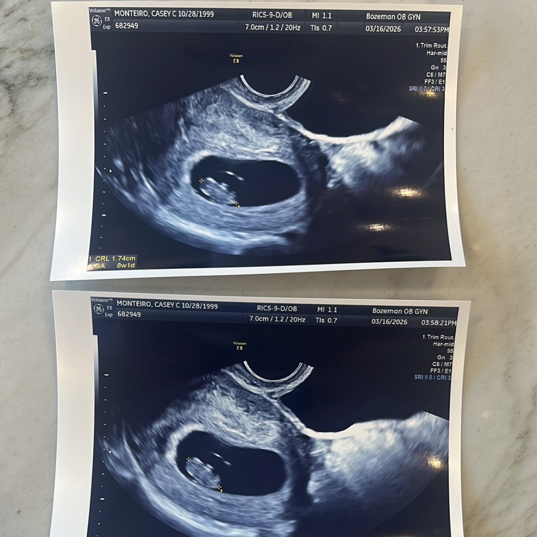 Photo shared by Casey for their Babylist baby registry.