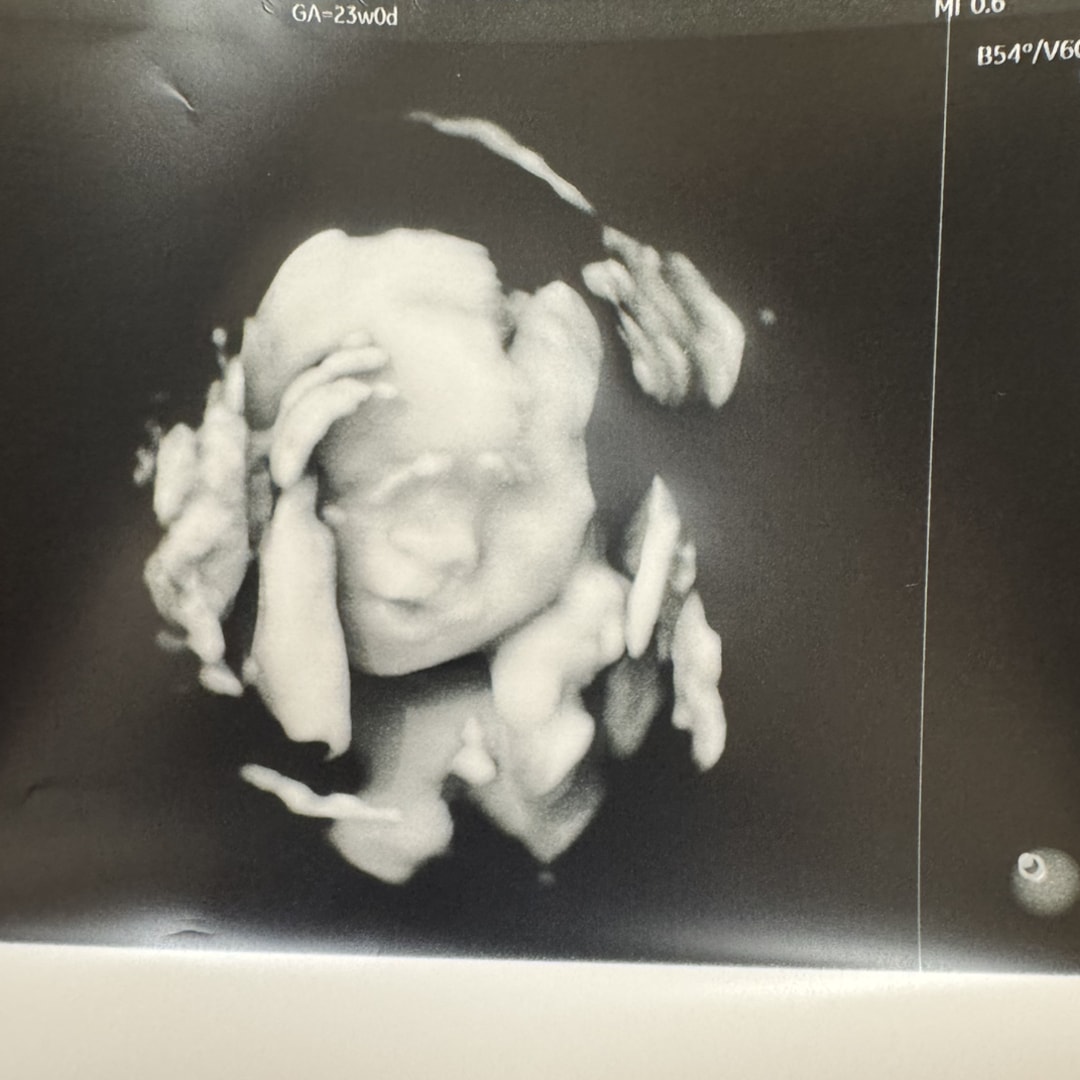 Photo shared by Amanda for their Babylist baby registry.