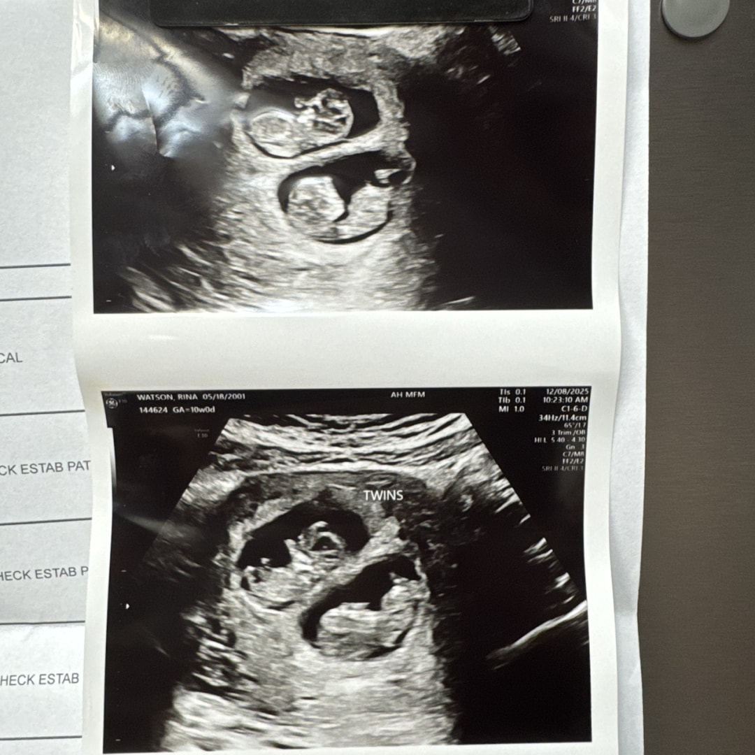 Photo shared by Rina for their Babylist baby registry.