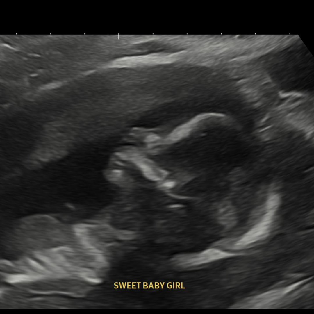 Photo shared by Lakyn for their Babylist baby registry.