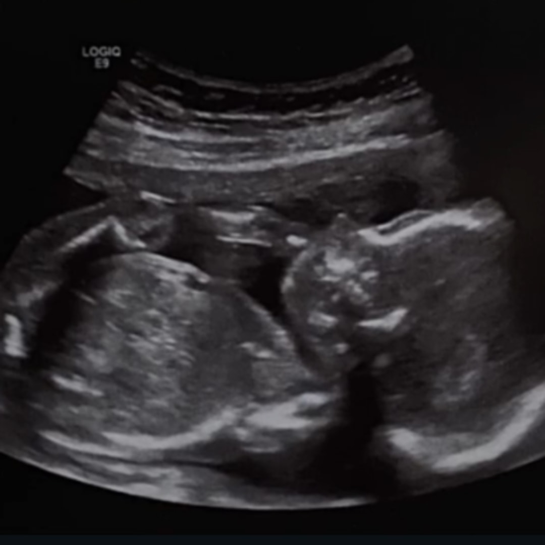 Photo shared by Stephanie for their Babylist baby registry.