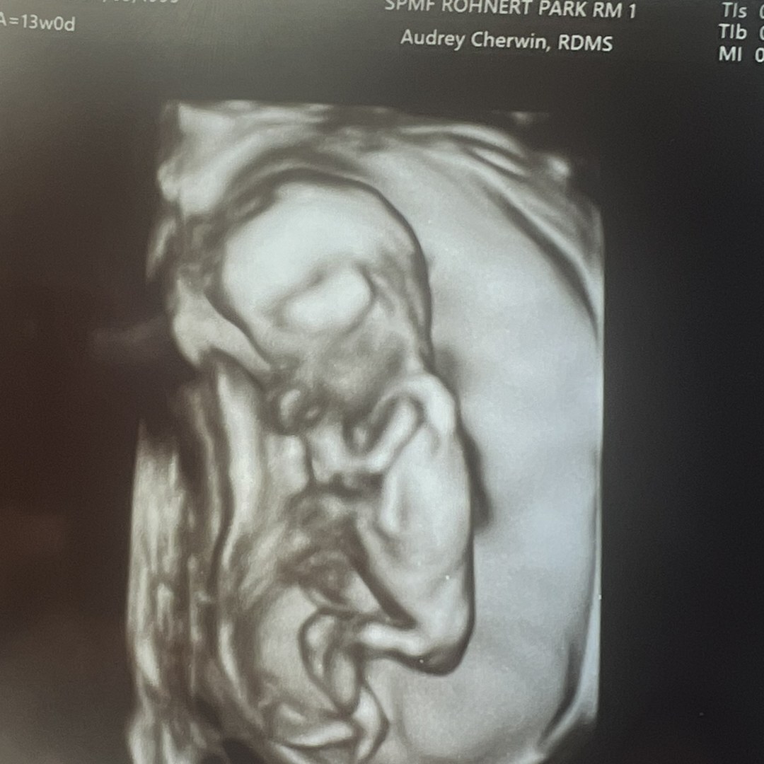 Photo shared by Courtney for their Babylist baby registry.
