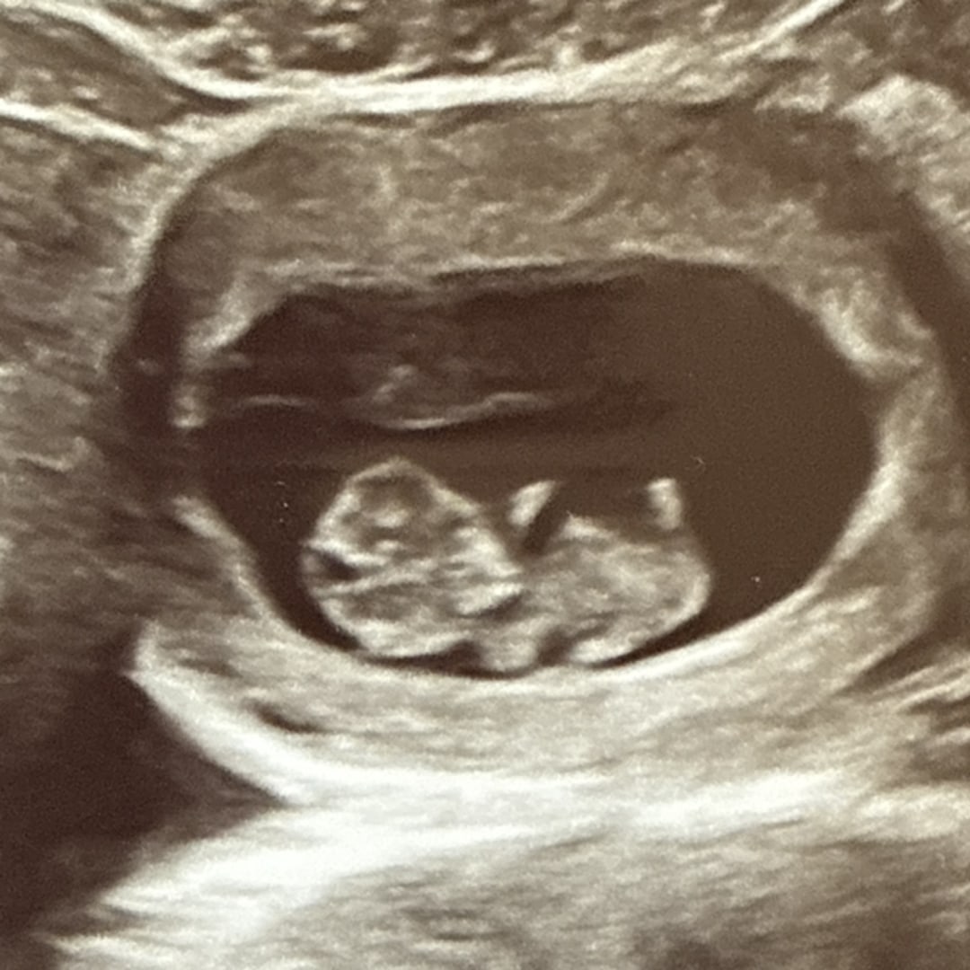 Photo shared by Jessica for their Babylist baby registry.